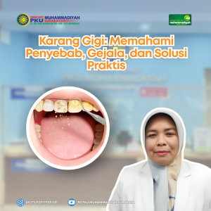 Read more about the article Karang Gigi: Memahami Penyebab, Gejala, dan Solusi Praktis