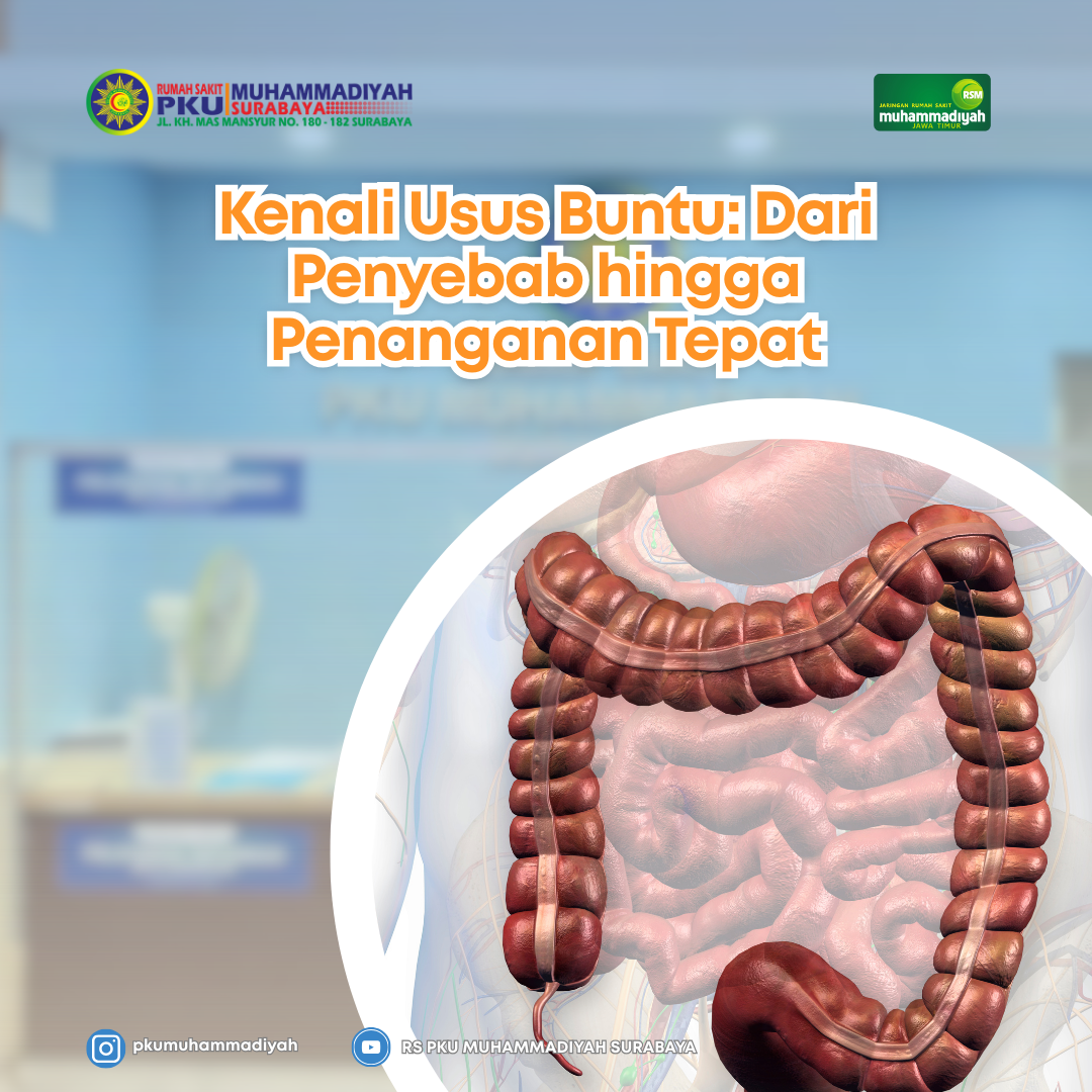 You are currently viewing Kenali Usus Buntu: Dari Penyebab hingga Penanganan Tepat