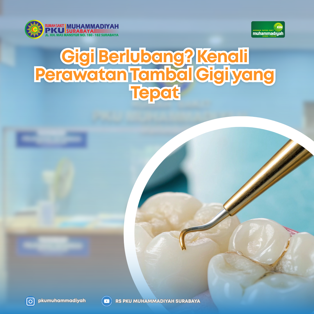 You are currently viewing Gigi Berlubang? Kenali Perawatan Tambal Gigi yang Tepat